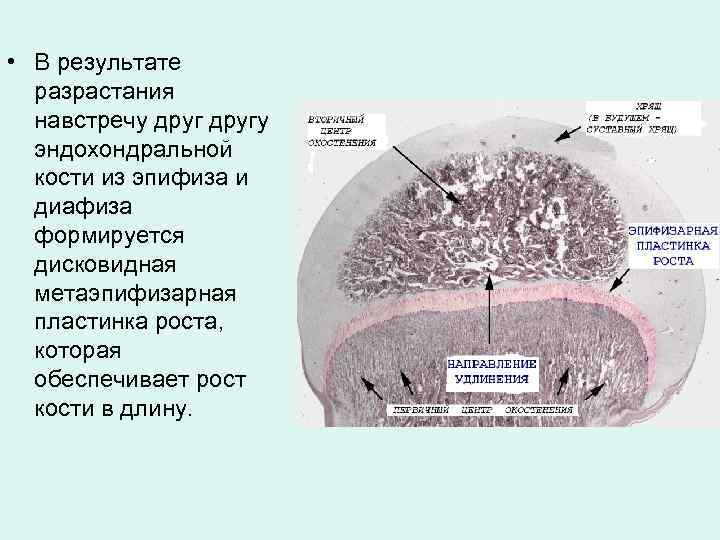  • В результате разрастания навстречу другу эндохондральной кости из эпифиза и диафиза формируется