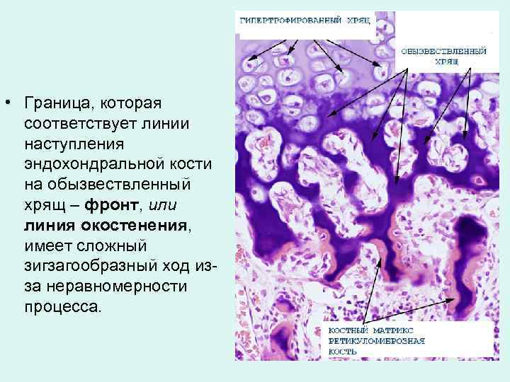  • Граница, которая соответствует линии наступления эндохондральной кости на обызвествленный хрящ – фронт,