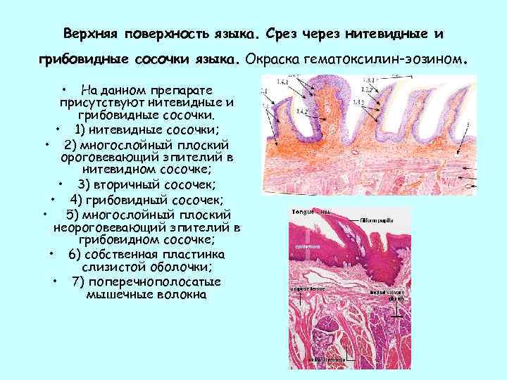 Верхняя поверхность языка. Срез через нитевидные и грибовидные сосочки языка. Окраска гематоксилин-эозином • На