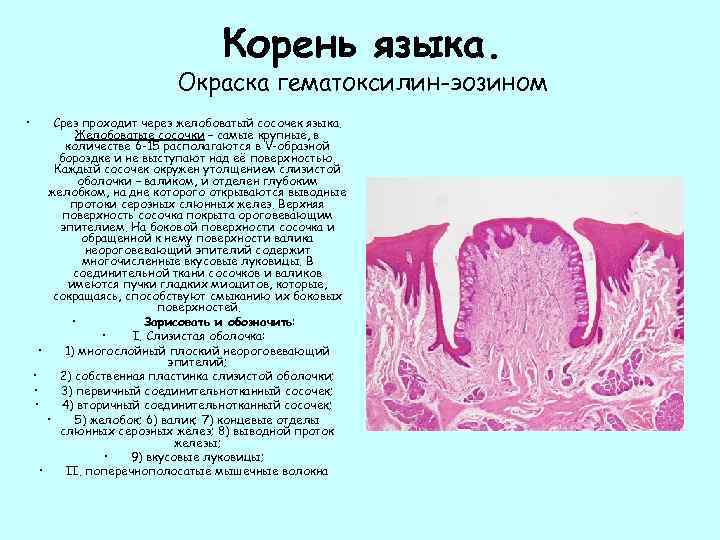 Корень языка. Окраска гематоксилин-эозином • • • Срез проходит через желобоватый сосочек языка. Желобоватые