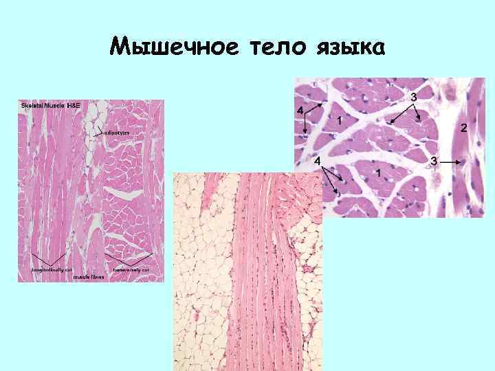Мышечное тело языка 