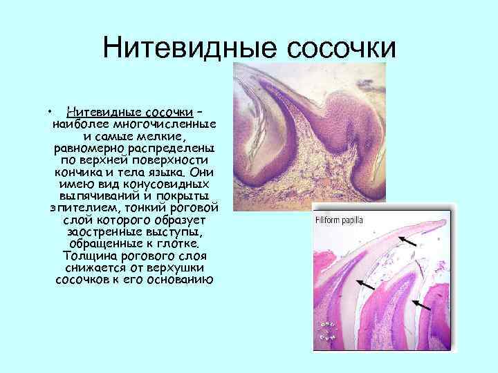 Нитевидные сосочки • Нитевидные сосочки – наиболее многочисленные и самые мелкие, равномерно распределены по