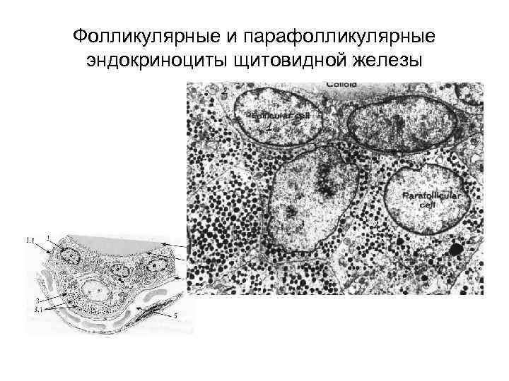 Фолликулярная щитовидная железа. Фолликулярные и парафолликулярные клетки щитовидной железы. Эндокриноциты щитовидной железы. Фолликулярные и парафолликулярные эндокриноциты щитовидной железы. Фолликулы эндокриноциты щитовидной железы.