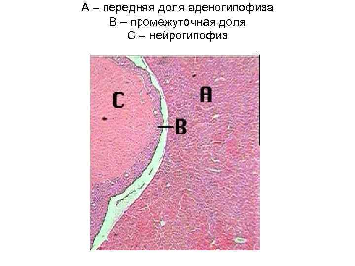 A – передняя доля аденогипофиза B – промежуточная доля C – нейрогипофиз 