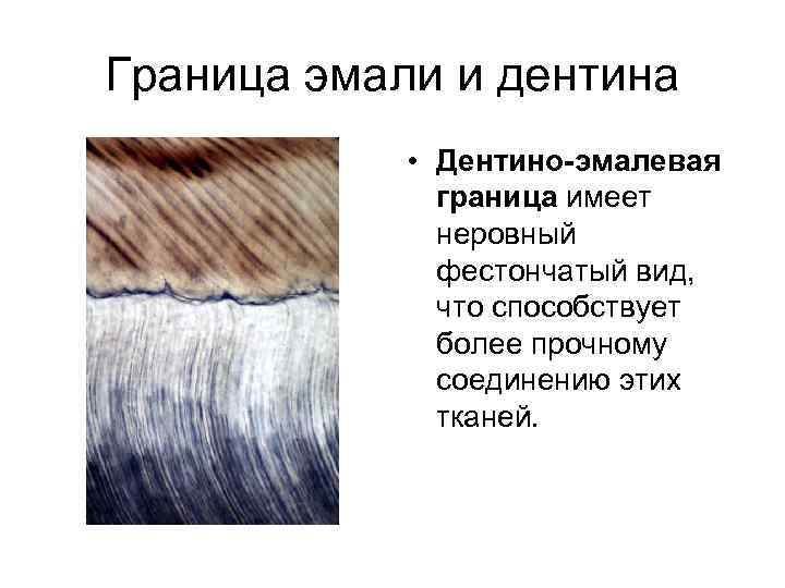Граница эмали и дентина • Дентино-эмалевая граница имеет неровный фестончатый вид, что способствует более