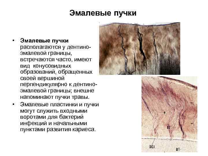 Эмалевые пучки • Эмалевые пучки располагаются у дентиноэмалевой границы, встречаются часто, имеют вид конусовидных