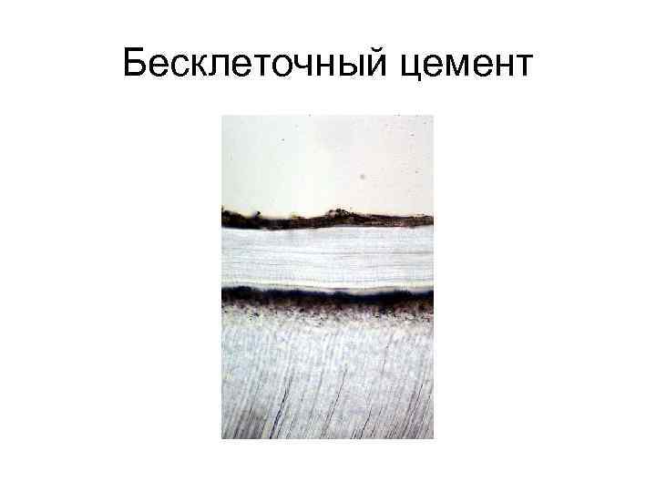 Бесклеточный цемент 