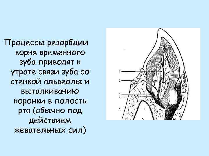 Процессы резорбции корня временного зуба приводят к утрате связи зуба со стенкой альвеолы и