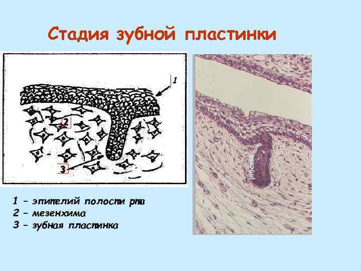 Стадия зубной пластинки 1 – эпителий полости рта 2 – мезенхима 3 – зубная
