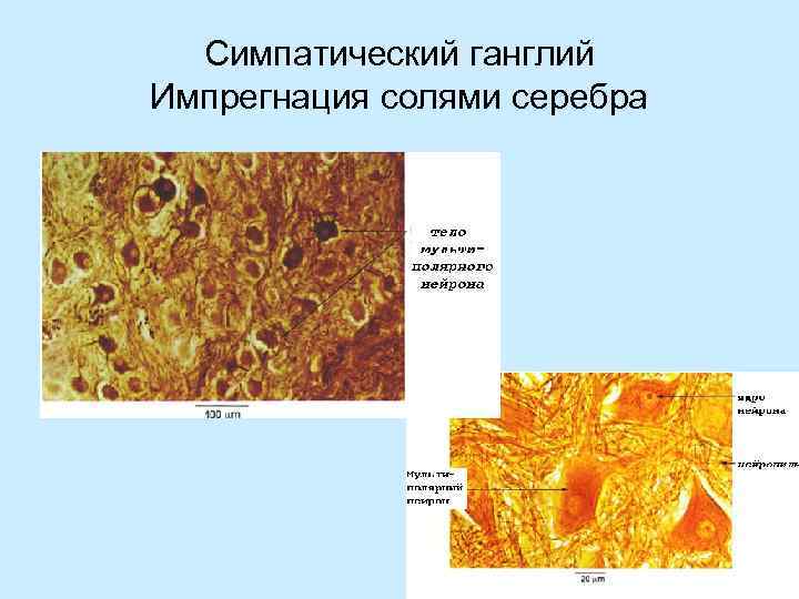 Симпатический ганглий Импрегнация солями серебра 