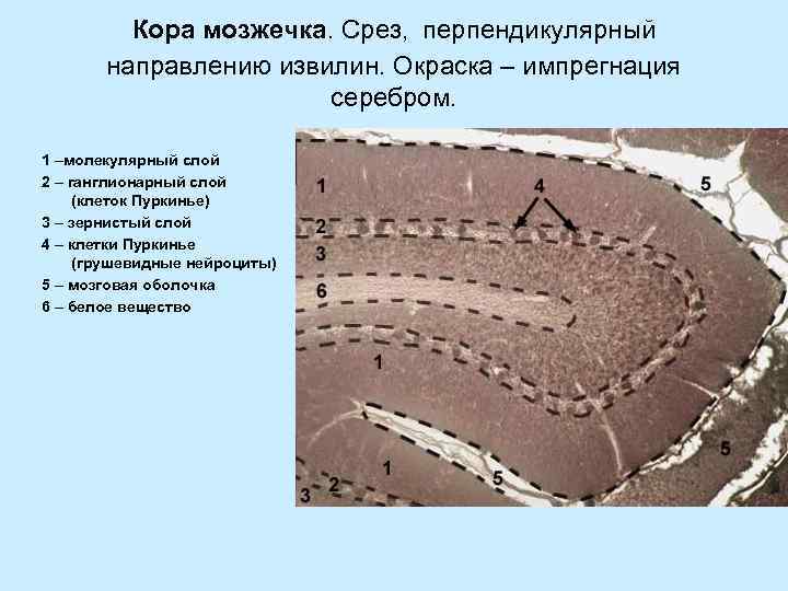 Кора мозжечка. Срез, перпендикулярный направлению извилин. Окраска – импрегнация серебром. 1 –молекулярный слой 2