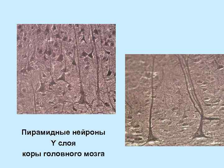 Пирамидные нейроны Y слоя коры головного мозга 