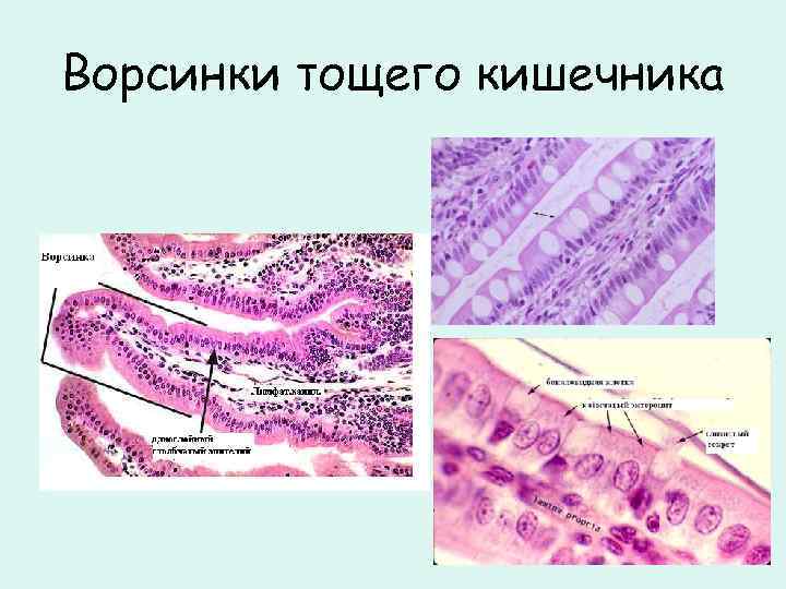 Ворсинки тощего кишечника 