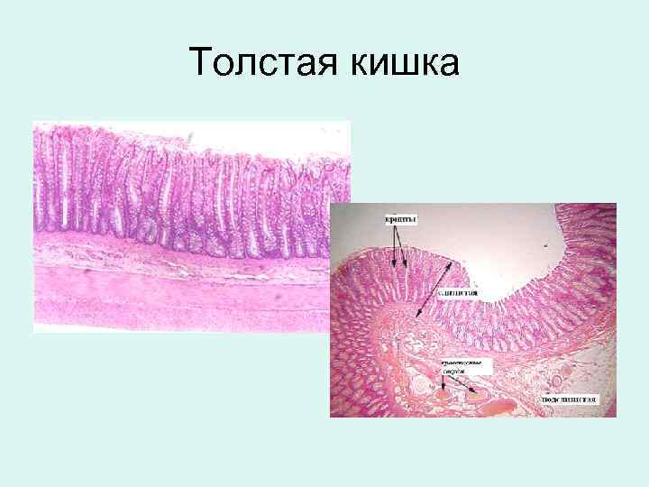Толстая кишка 