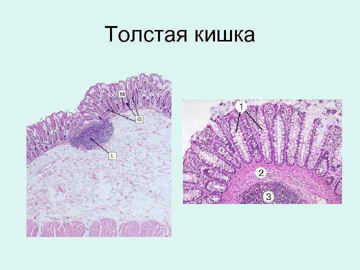 Толстая кишка 
