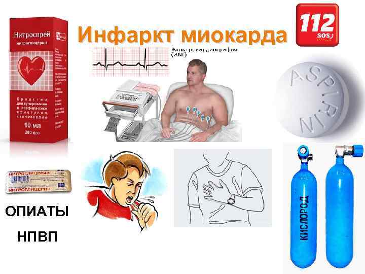 Инфаркт миокарда ОПИАТЫ НПВП 