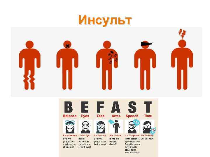 Инсульт 