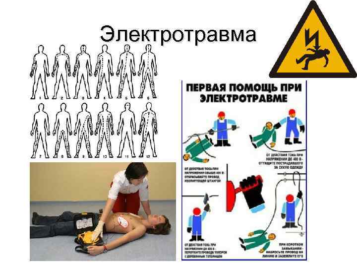 Электротравма 