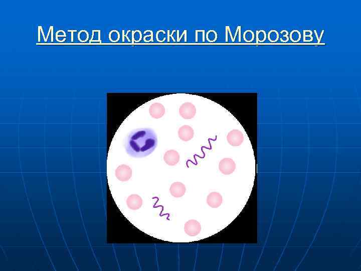 Метод окраски по Морозову 