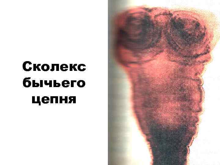 Сколекс бычьего цепня 
