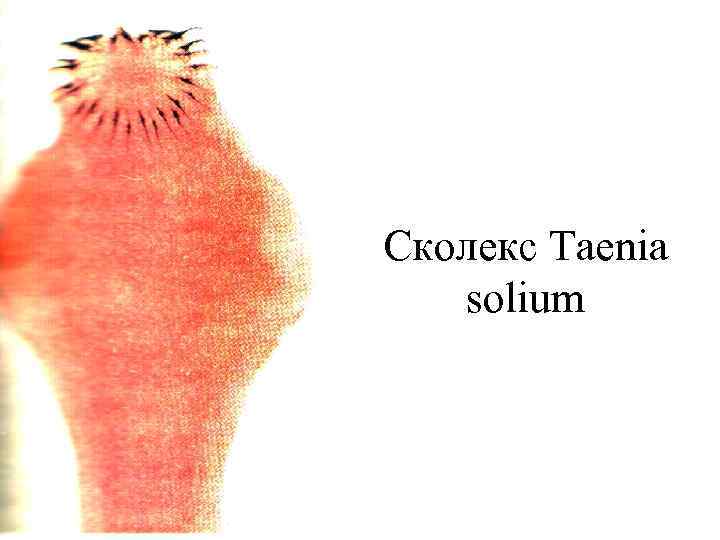 Сколекс Taenia solium 