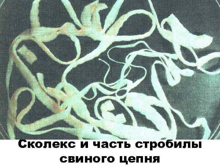Сколекс и часть стробилы свиного цепня 