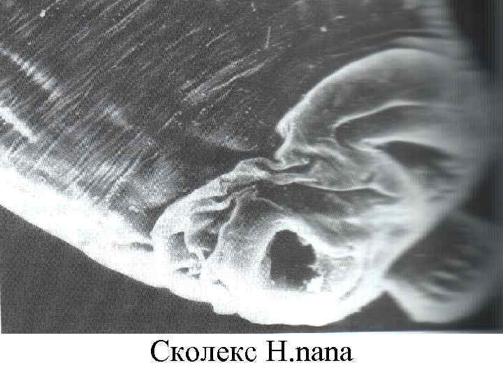 Сколекс H. nana 