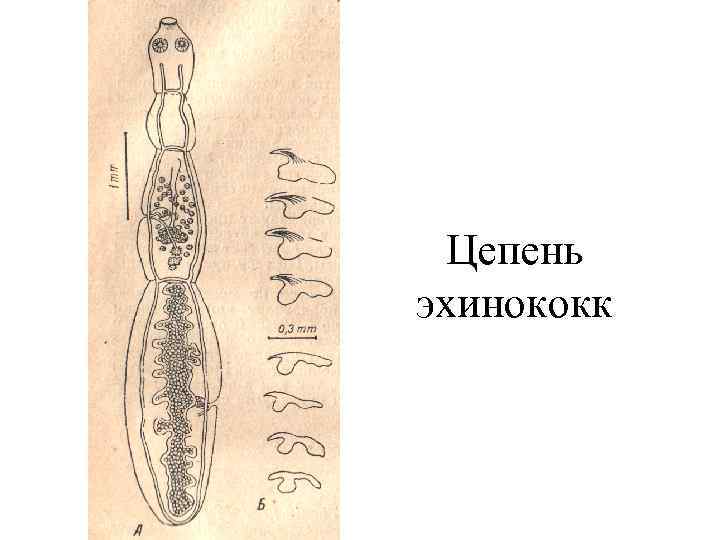 Цепень эхинококк 