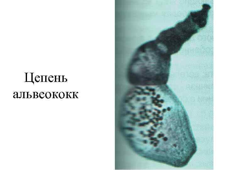 Цепень альвеококк 