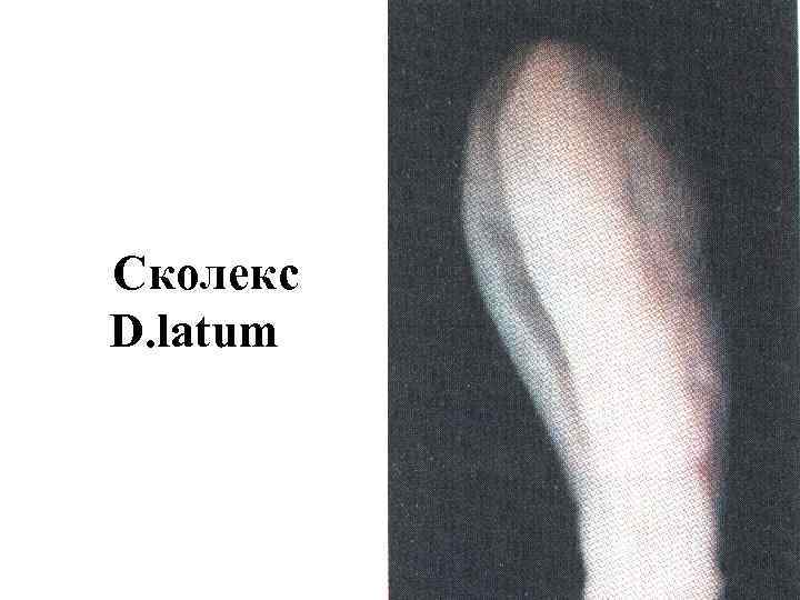 Сколекс D. latum 