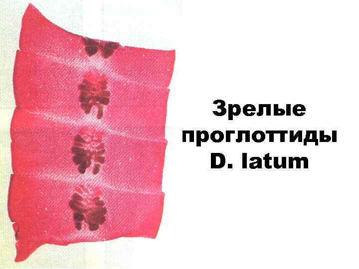 Зрелые проглоттиды D. latum 