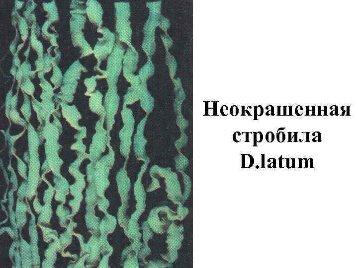 Неокрашенная стробила D. latum 