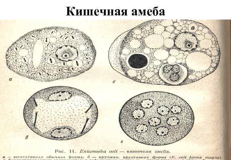 Кишечная амеба 