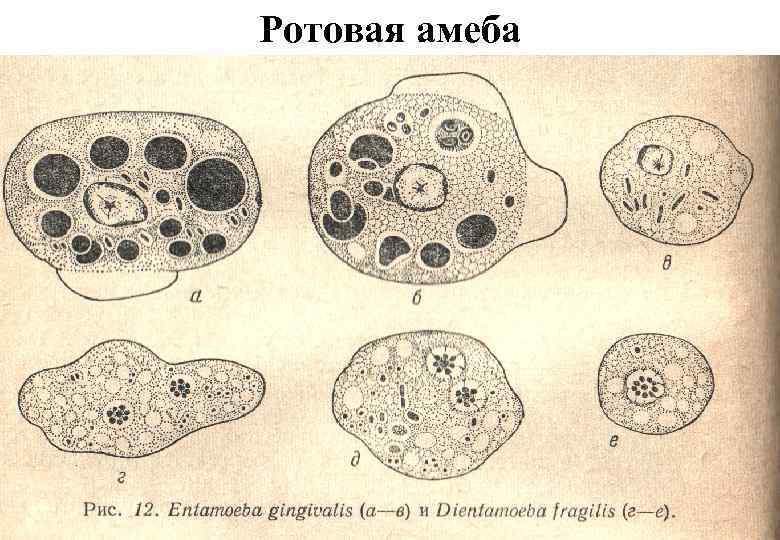 Ротовая амеба 
