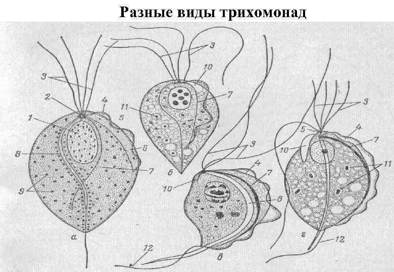 Разные виды трихомонад 