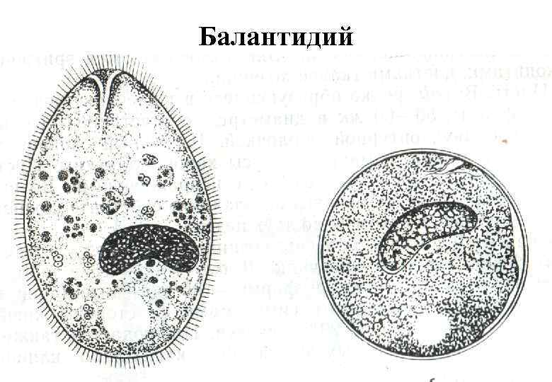 Балантидий 