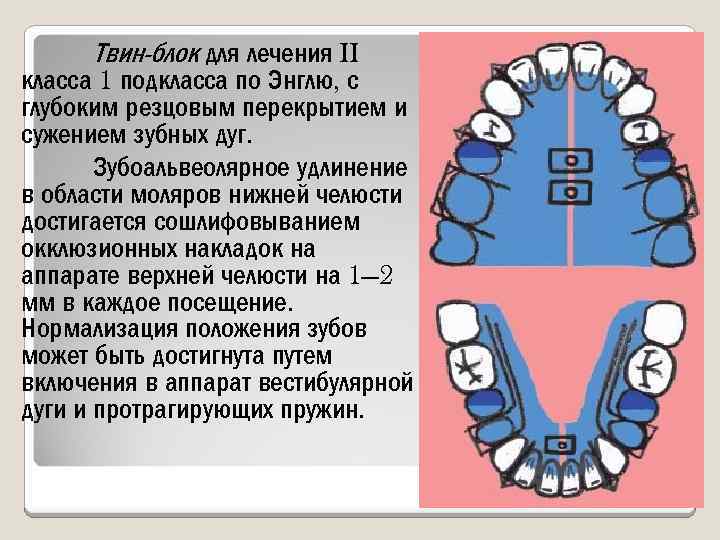 Молярно резцовая гипоплазия. Высота резцового перекрытия. Обратное резцовое перекрытие. Перекрестный прикус верхняя челюсть. Трансверзальная резцовая окклюзия.