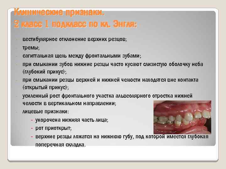 Клинические признаки. 2 класс 1 подкласс по кл. Энгля: вестибулярное отклонение верхних резцов; тремы;