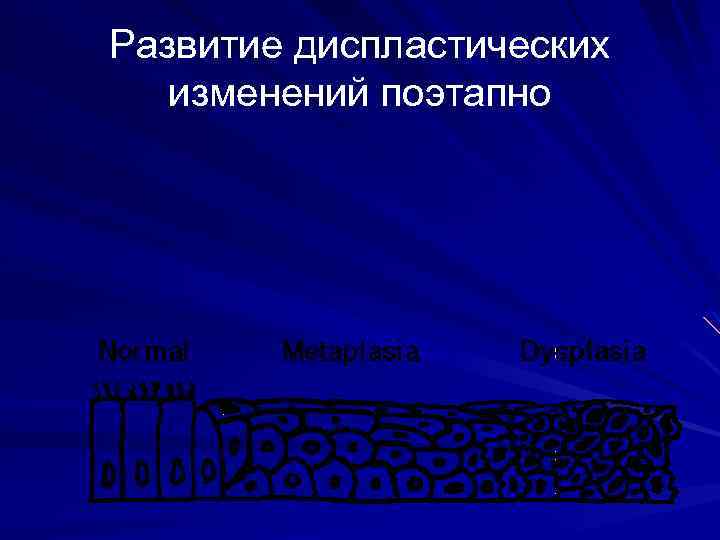 Развитие диспластических изменений поэтапно 