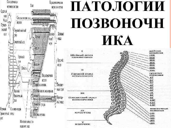 ПАТОЛОГИИ ПОЗВОНОЧН ИКА 