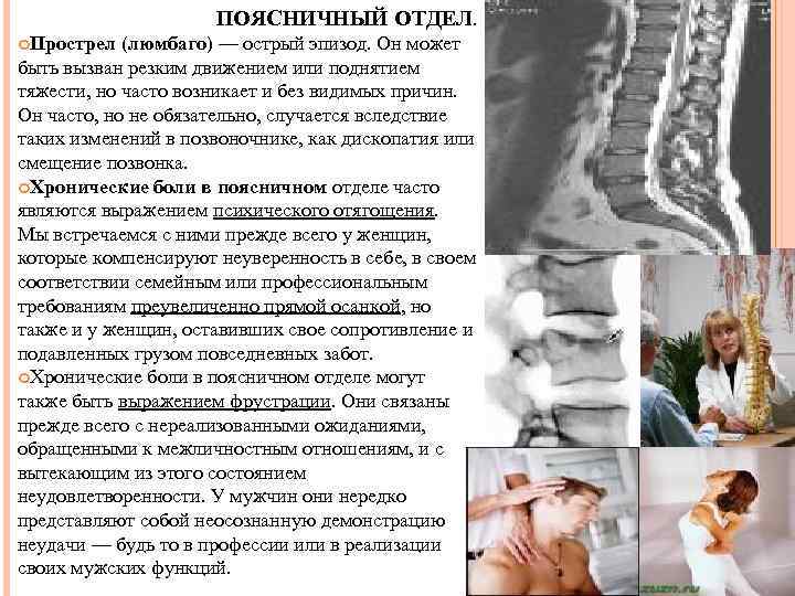ПОЯСНИЧНЫЙ ОТДЕЛ. Прострел (люмбаго) — острый эпизод. Он может быть вызван резким движением или