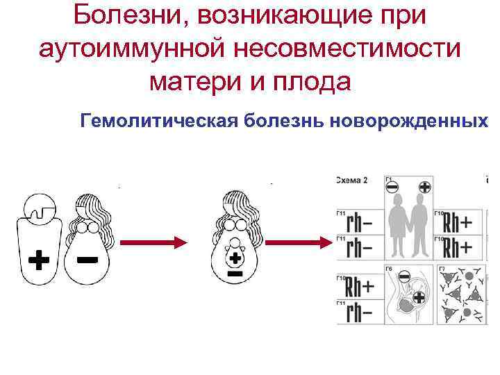 Болезни, возникающие при аутоиммунной несовместимости матери и плода Гемолитическая болезнь новорожденных 