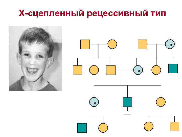 Х-сцепленный рецессивный тип 