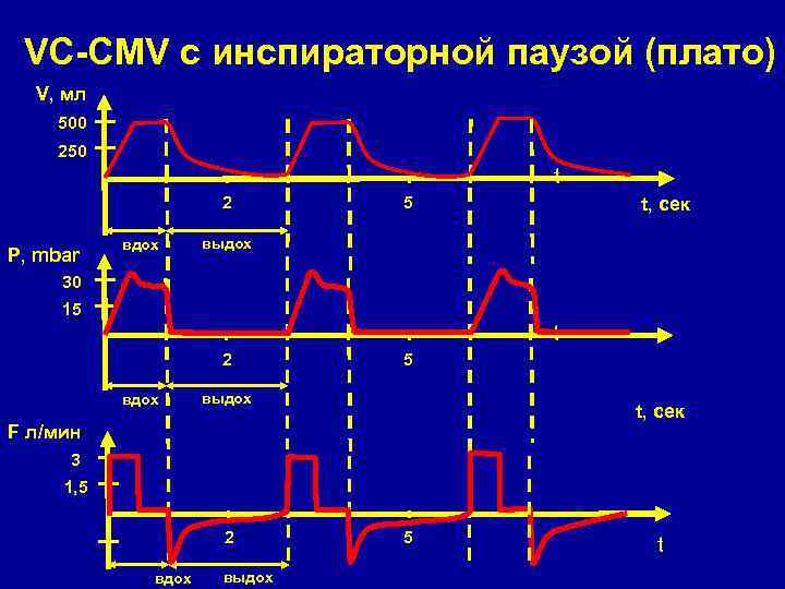 VC-CMV с инспираторной паузой (плато) V, мл 500 250 t 2 P, mbar вдох