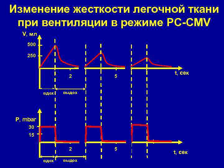 Изменение жесткости легочной ткани при вентиляции в режиме РC-CMV V, мл 500 250 2