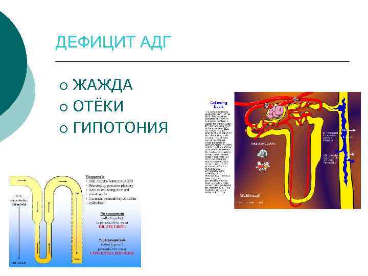 ДЕФИЦИТ АДГ ЖАЖДА ¡ ОТЁКИ ¡ ГИПОТОНИЯ ¡ 
