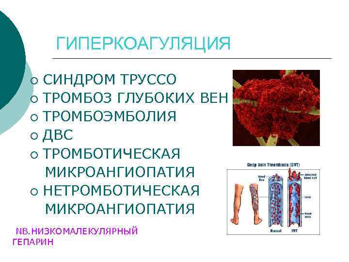 ГИПЕРКОАГУЛЯЦИЯ СИНДРОМ ТРУССО ¡ ТРОМБОЗ ГЛУБОКИХ ВЕН ¡ ТРОМБОЭМБОЛИЯ ¡ ДВС ¡ ТРОМБОТИЧЕСКАЯ МИКРОАНГИОПАТИЯ