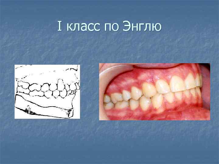 I класс по Энглю 