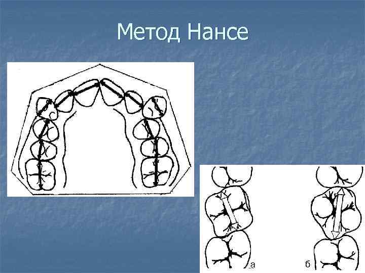 Метод Нансе 