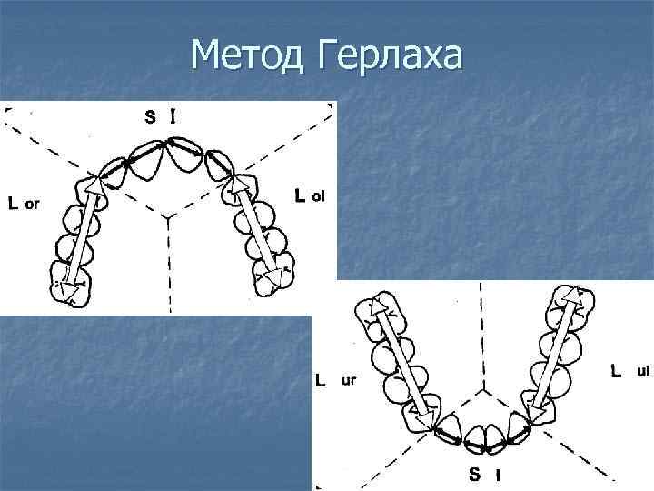 Метод Герлаха 